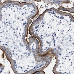 NAALADase-like 2/NAALADL2 Antibody, Novus Biologicals 0.1mL; Unlabeled:Antibodies,