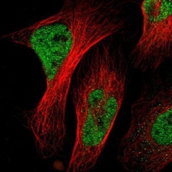 NAC1 Antibody, Novus Biologicals:Antibodies:Primary Antibodies