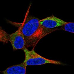 NACAD Antibody, Novus Biologicals 25 &mu;L; Unlabeled:Antibodies, Polyclonal