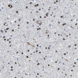 NACAD Antibody, Novus Biologicals 25 &mu;L; Unlabeled:Antibodies, Polyclonal