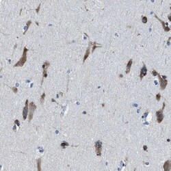 NACAD Antibody, Novus Biologicals 25 &mu;L; Unlabeled:Antibodies, Polyclonal