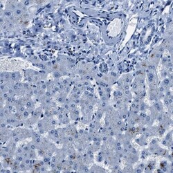 NACAD Antibody, Novus Biologicals 25 &mu;L; Unlabeled:Antibodies, Polyclonal