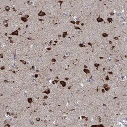 NACAD Rabbit anti-Human, Polyclonal, Novus Biologicals:Antibodies:Primary