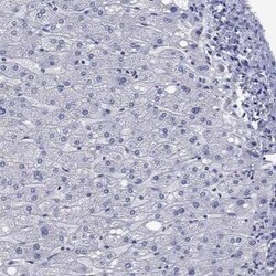 NACAD Rabbit anti-Human, Polyclonal, Novus Biologicals:Antibodies:Primary