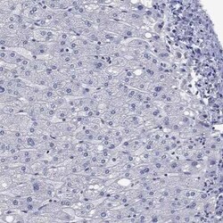 NACAD Rabbit anti-Human, Polyclonal, Novus Biologicals:Antibodies:Primary