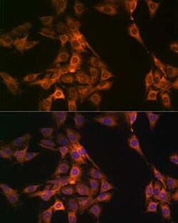 NAP1L1 Rabbit anti-Human, Mouse, Rat, Clone: 4W8B6, Novus Biologicals:Antibodies:Primary