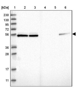 NAP1L1 Antibody, Novus Biologicals 25 &mu;L; Unlabeled:Antibodies, Polyclonal