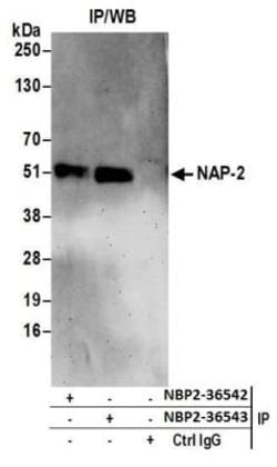 NAP1L4 Antibody, Novus Biologicals 100 &mu;L | Buy Online | Novus Biologicals | Fisher Scientific