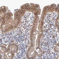 NAPRT1 Antibody, Novus Biologicals:Antibodies:Primary Antibodies