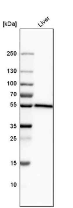 NAPRT1 Antibody, Novus Biologicals 25 &mu;L; Unlabeled:Antibodies, Polyclonal