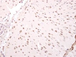 NARF Antibody, Novus Biologicals 0.1mL; Unlabeled:Antibodies, Polyclonal
