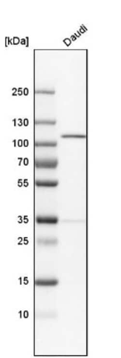 NARG1 Antibody, Novus Biologicals 0.1mL; Unlabeled:Antibodies, Polyclonal