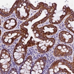 NARG1L Antibody, Novus Biologicals 0.1mL; Unlabeled:Antibodies, Polyclonal