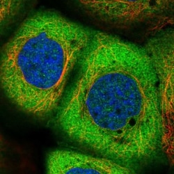 NARS Antibody, Novus Biologicals:Antibodies:Primary Antibodies