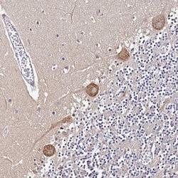 NARS Antibody, Novus Biologicals:Antibodies:Primary Antibodies