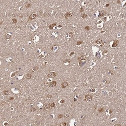 NARS Antibody, Novus Biologicals:Antibodies:Primary Antibodies