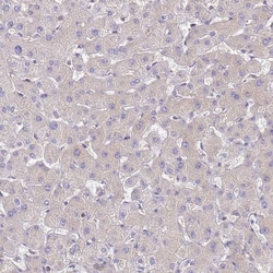 NARS Antibody, Novus Biologicals:Antibodies:Primary Antibodies