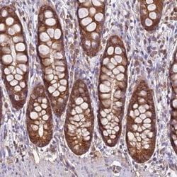 NARS Antibody, Novus Biologicals:Antibodies:Primary Antibodies