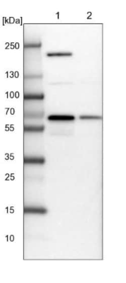 NARS Antibody, Novus Biologicals:Antibodies:Primary Antibodies