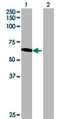 Novus Biologicals&trade;&nbsp;NARS2 293T Cell Transient Overexpression Lysate