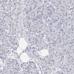 NASP Antibody, Novus Biologicals 25 &mu;L | Buy Online | Novus Biologicals | Fisher Scientific