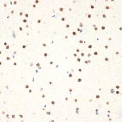 NAT10 Rabbit anti-Human, Mouse, Rat, Clone: 5Z3E5, Novus Biologicals 100