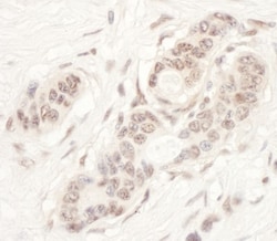 NAT10 Antibody, Novus Biologicals 0.1mg; Unlabeled:Antibodies, Polyclonal
