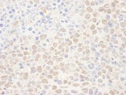 NAT10 Antibody, Novus Biologicals 0.1mg; Unlabeled:Antibodies, Polyclonal