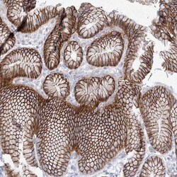 NAT11 Antibody, Novus Biologicals 0.1mL; Unlabeled:Antibodies, Polyclonal