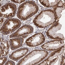 NAV1 Antibody, Novus Biologicals:Antibodies:Primary Antibodies