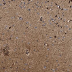 NAV1 Antibody, Novus Biologicals 0.1mL; Unlabeled:Antibodies, Polyclonal