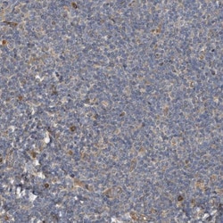 NAV1 Antibody, Novus Biologicals 0.1mL; Unlabeled:Antibodies, Polyclonal