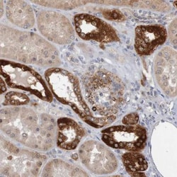 NAV2 Antibody, Novus Biologicals:Antibodies:Primary Antibodies