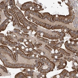 NAV3 Antibody, Novus Biologicals:Antibodies:Primary Antibodies