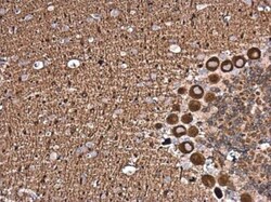 NCALD Antibody, Novus Biologicals 0.1 mL | Buy Online | Novus Biologicals | Fisher Scientific