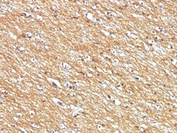 NCAM-1/CD56 Antibody (NCAM1/795), Novus Biologicals 0.2mg; Unlabeled:Antibodies,