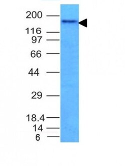 NCAM-1/CD56 Antibody (NCAM1/795), Novus Biologicals 0.2mg; Unlabeled:Antibodies,