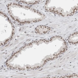 NCAPG2 Antibody, Novus Biologicals 25 &mu;L | Buy Online | Novus Biologicals | Fisher Scientific
