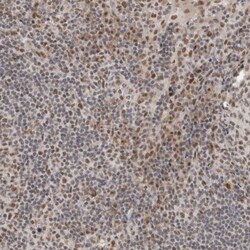 NCAPG2 Antibody, Novus Biologicals 25 &mu;L | Buy Online | Novus Biologicals | Fisher Scientific