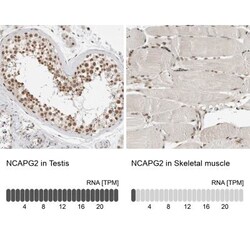 NCAPG2 Antibody, Novus Biologicals 25 &mu;L | Buy Online | Novus Biologicals | Fisher Scientific