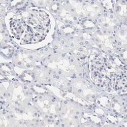 NCAPH Antibody, Novus Biologicals:Antibodies:Primary Antibodies