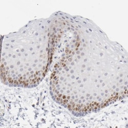 NCAPH Antibody, Novus Biologicals:Antibodies:Primary Antibodies