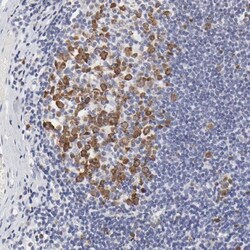 NCAPH Antibody, Novus Biologicals:Antibodies:Primary Antibodies
