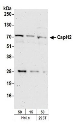NCAPH2 Antibody, Novus Biologicals 0.1mg; Unlabeled:Antibodies, Polyclonal