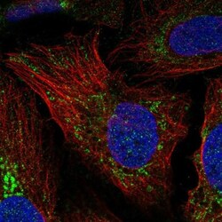 NCCRP1 Antibody, Novus Biologicals 0.1mL; Unlabeled:Antibodies, Polyclonal