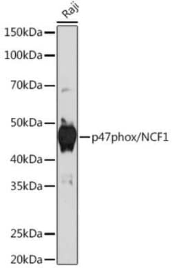 NCF1 Rabbit anti-Human, Clone: 8J2F6, Novus Biologicals 100 &mu;g | Buy Online | Novus Biologicals | Fisher Scientific