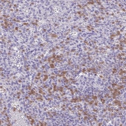 NCF1 Antibody, Novus Biologicals 25 &mu;L, Unlabeled:Antibodies, Polyclonal