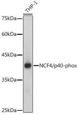 NCF4 Rabbit anti-Human, Mouse, Clone: 4L9Z4, Novus Biologicals:Antibodies:Primary