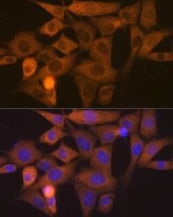 NCK1 Rabbit anti-Human, Mouse, Rat, Clone: 4R1N9, Novus Biologicals:Antibodies:Primary