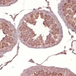 NCK1 Rabbit anti-Human, Mouse, Rat, Clone: 4R1N9, Novus Biologicals:Antibodies:Primary